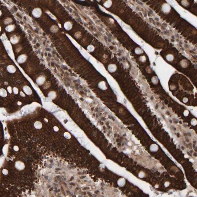 Anti-CCDC57 antibody produced in rabbit