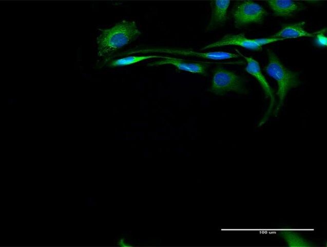 Anti-CAPN2 antibody produced in rabbit