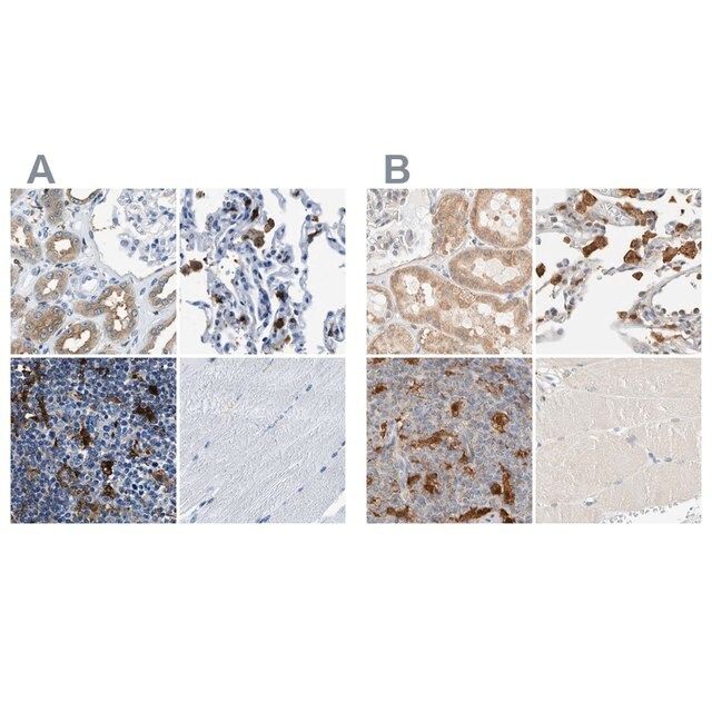 Anti-CAPG antibody produced in rabbit