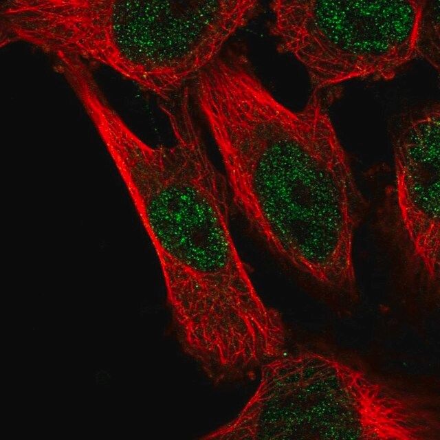 Anti-CAPZB antibody produced in rabbit