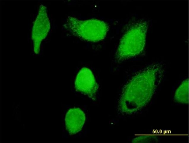 Anti-CAPN1 antibody produced in mouse