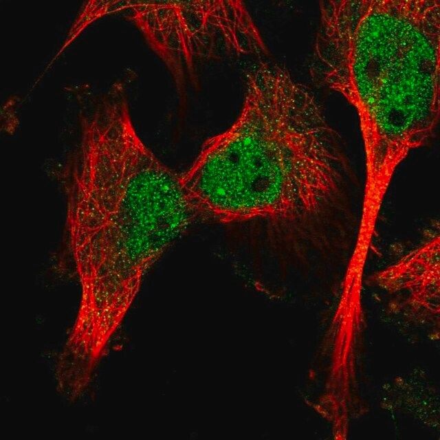 Anti-CAPN10 antibody produced in rabbit