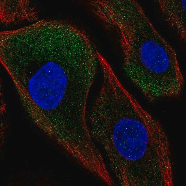 Anti-CAPNS2 antibody produced in rabbit