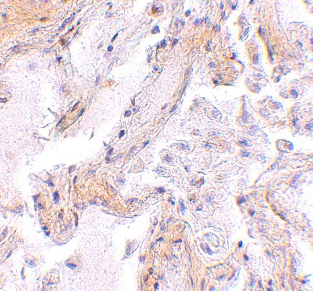 Anti-CAPN6 antibody produced in rabbit