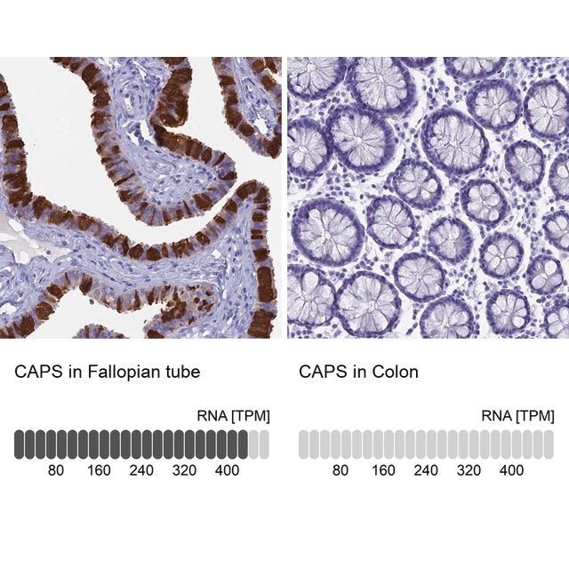 Anti-CAPS antibody produced in rabbit