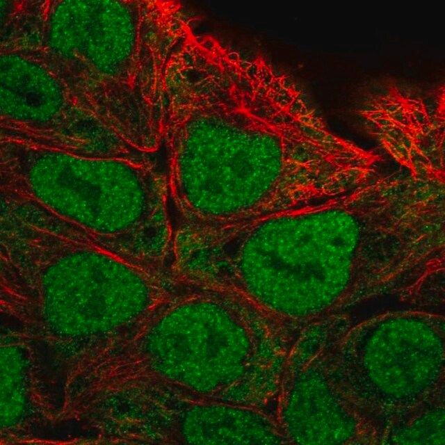 Anti-CAPN13 antibody produced in rabbit