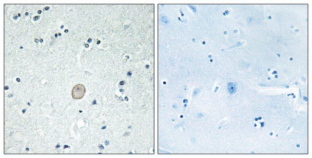 Anti-C3AR1 antibody produced in rabbit