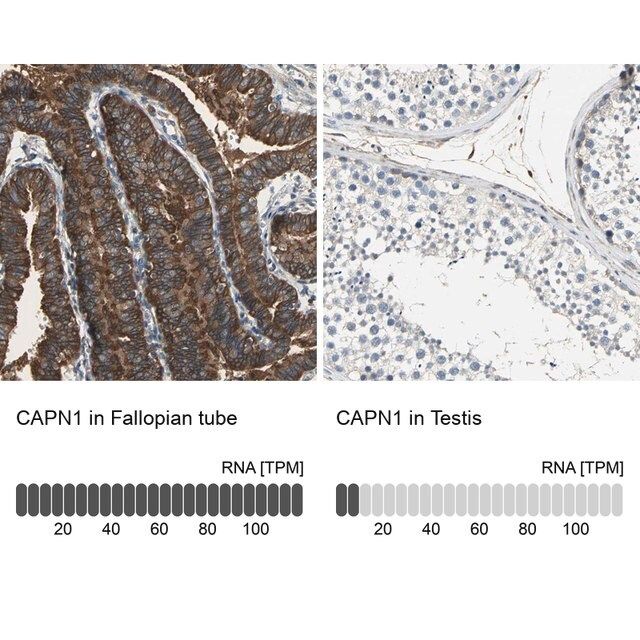 Anti-CAPN1 antibody produced in rabbit