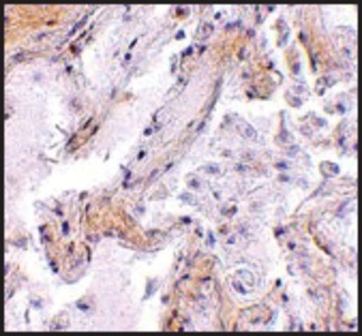 Anti-CAPN6 antibody produced in rabbit