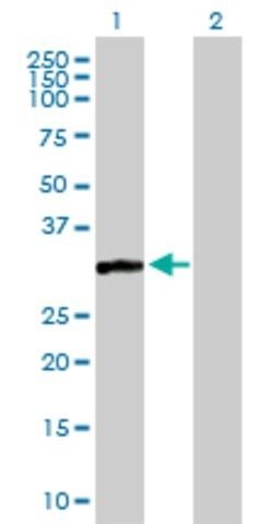 Anti-CAPZA3 antibody produced in mouse