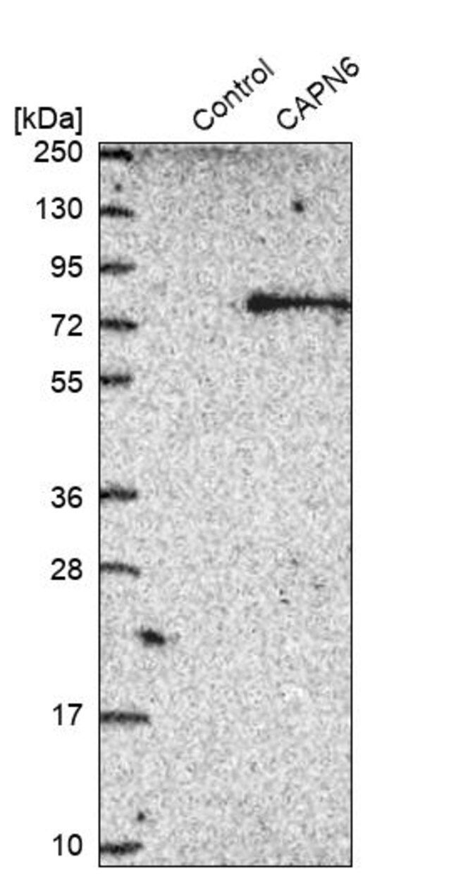 Anti-CAPN6 antibody produced in rabbit