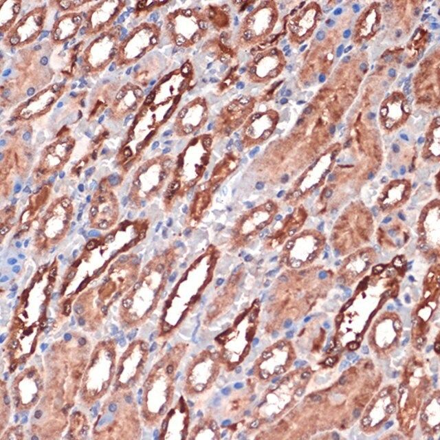 Anti-Carbonic Anhydrase 1 (CA2) antibody produced in rabbit