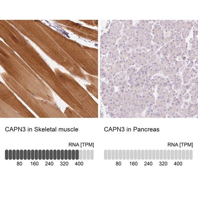 Anti-CAPN3 antibody produced in rabbit