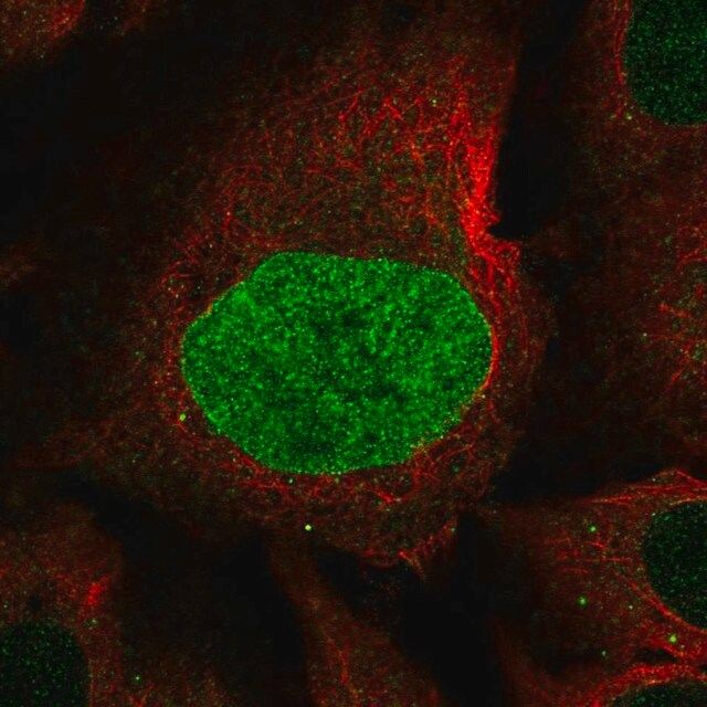 Anti-CAPN8 antibody produced in rabbit