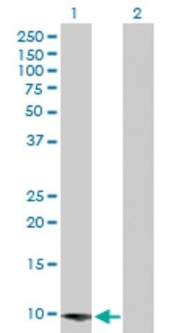 Anti-CARD16 antibody produced in rabbit