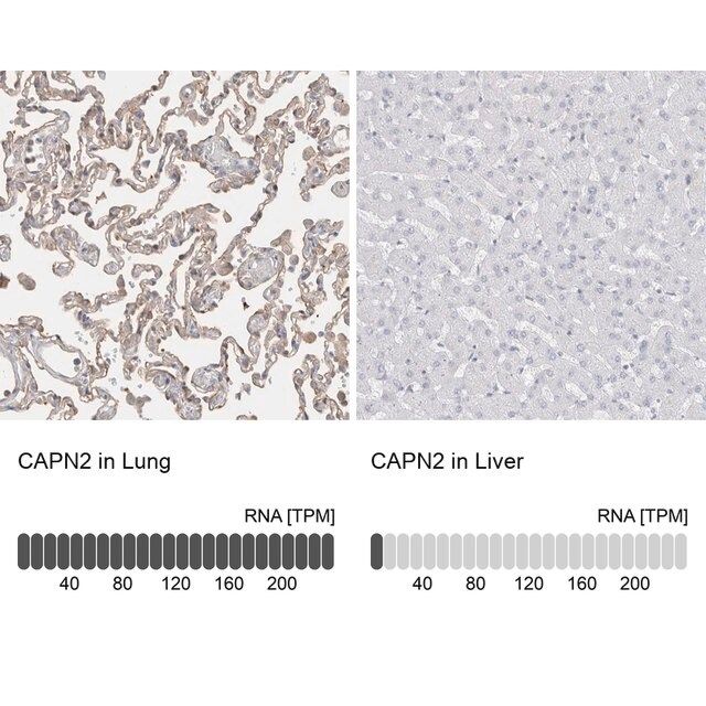 Anti-CAPN2 antibody produced in rabbit