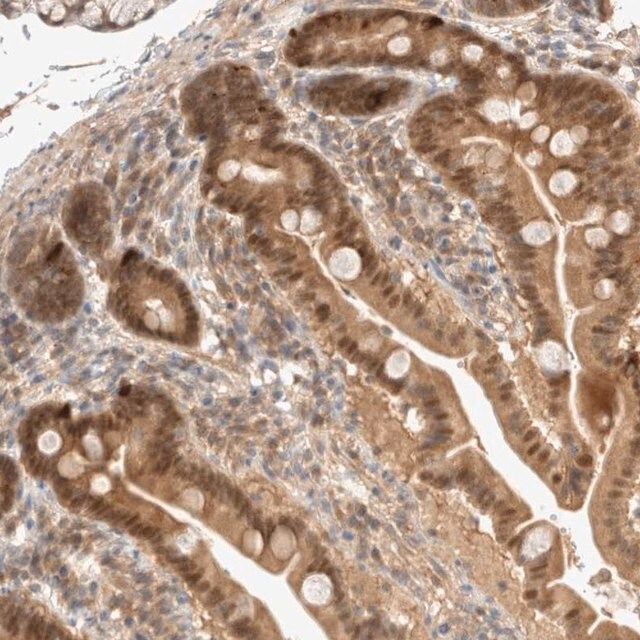 Anti-CARNMT1 antibody produced in rabbit