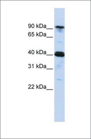 Anti-CARS antibody produced in rabbit