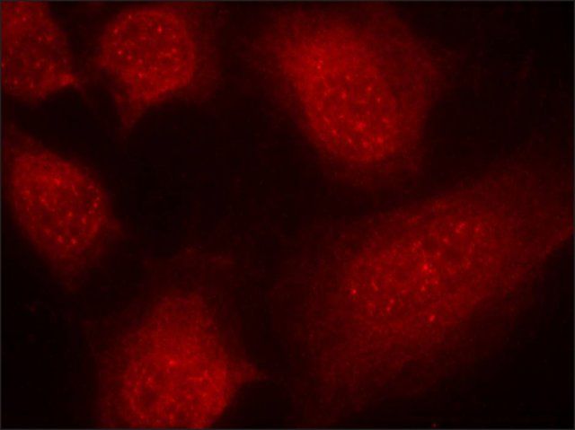 Anti-CARM1 (Ab-228) antibody produced in rabbit