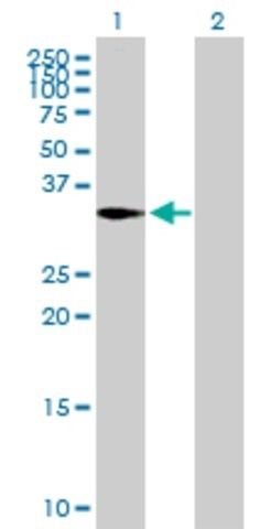 Anti-CAPZA2 antibody produced in mouse