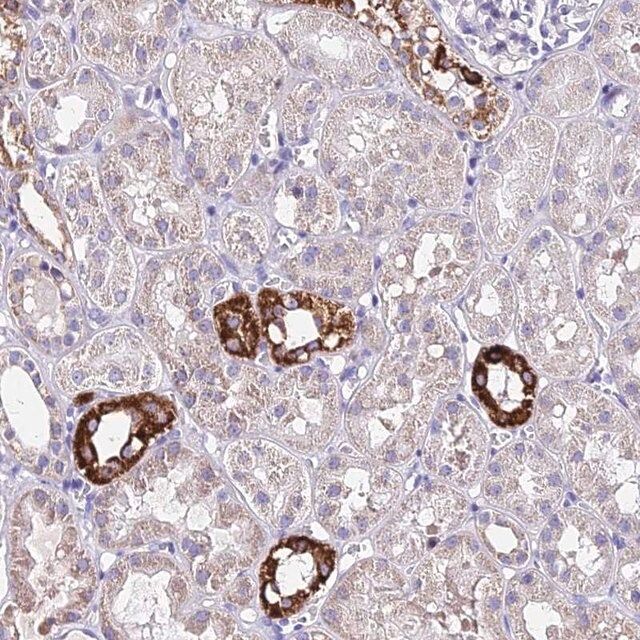 Anti-CARD18 antibody produced in rabbit