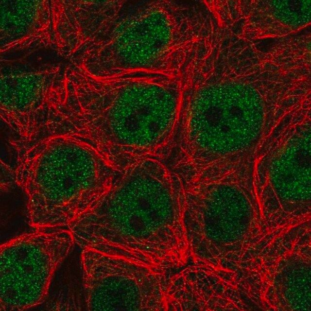 Anti-CARM1 antibody produced in rabbit