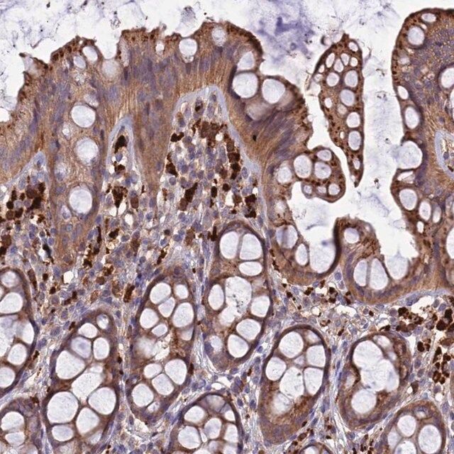 Anti-CARMIL2 antibody produced in rabbit