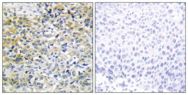 Anti-CARKL antibody produced in rabbit