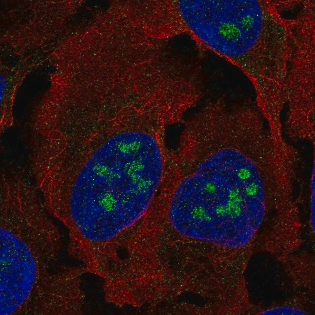 Anti-BLCAP antibody produced in rabbit