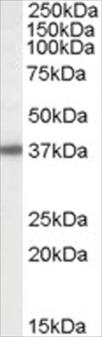 Anti-Bisphosphate 3-nucleotidase antibody produced in goat