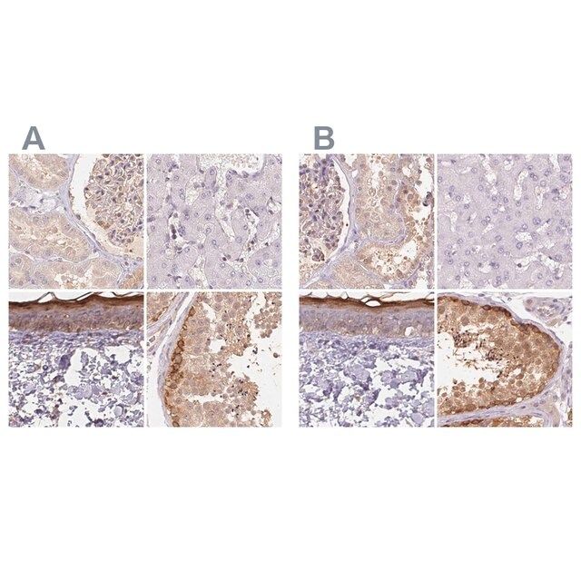 Anti-BLMH antibody produced in rabbit