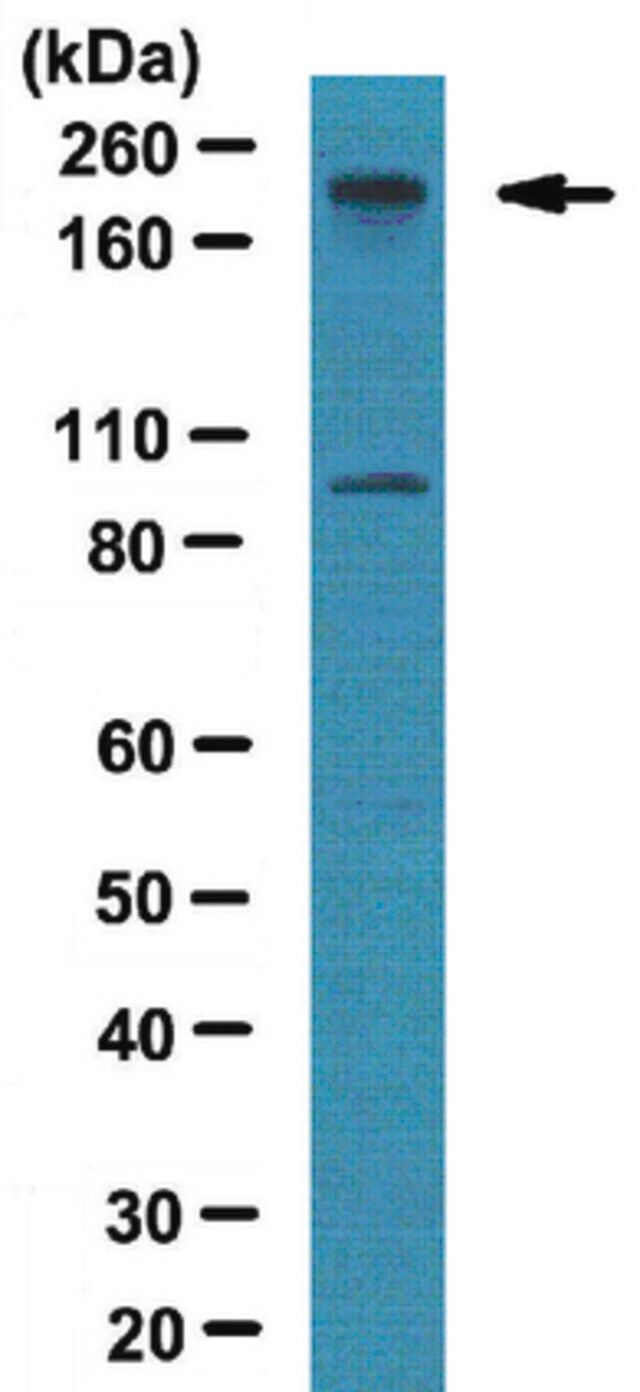 Anti-BAF180 Antibody