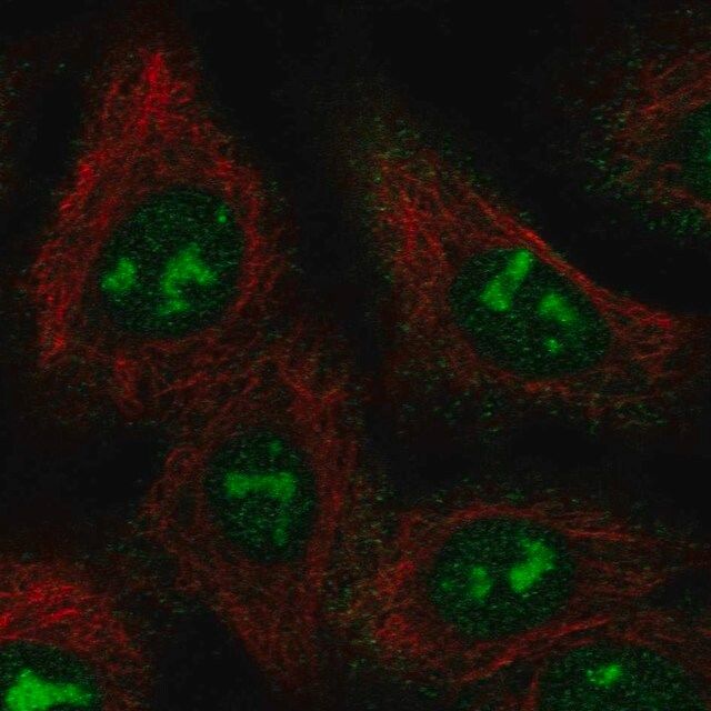 Anti-BAHCC1 antibody produced in rabbit