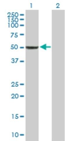 Anti-BAG5 antibody produced in rabbit