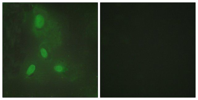 Anti-BACH1 antibody produced in rabbit