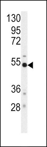 ANTI-BACE (S498) antibody produced in rabbit