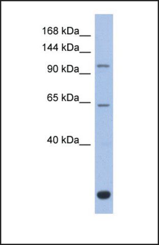 Anti-BACH2 antibody produced in rabbit