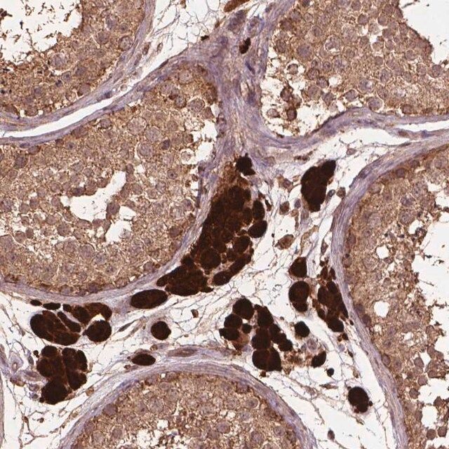 Anti-BABAM1 antibody produced in rabbit