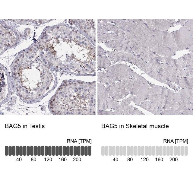 Anti-BAG5 antibody produced in rabbit