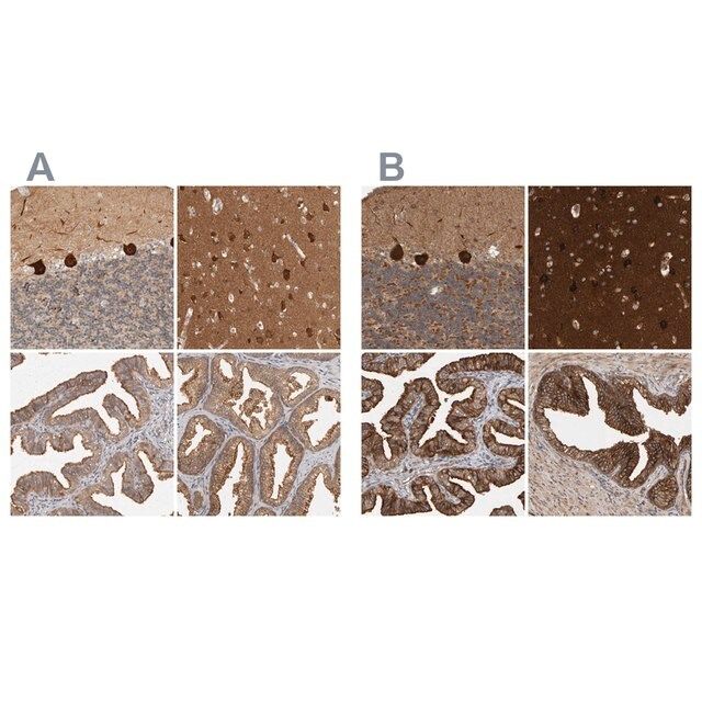 Anti-BAIAP2 antibody produced in rabbit