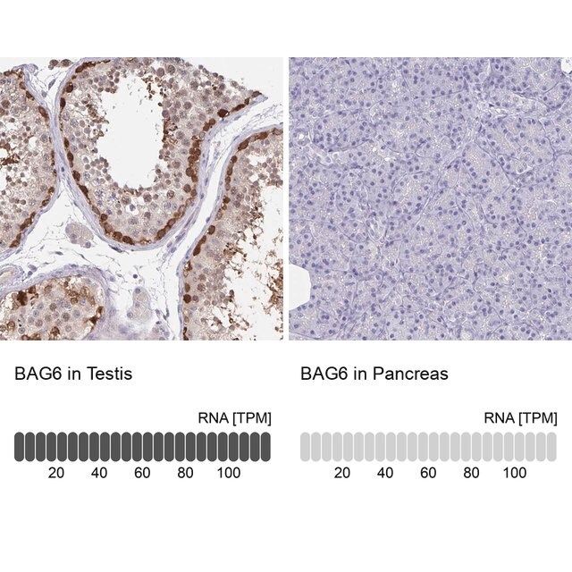 Anti-BAG6 antibody produced in rabbit