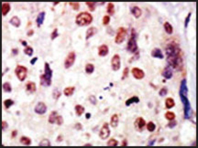 Anti-BAI1 (C-term) antibody produced in rabbit