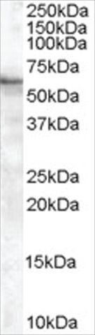 Anti-BAIAP2 (Isoform 2) antibody produced in goat