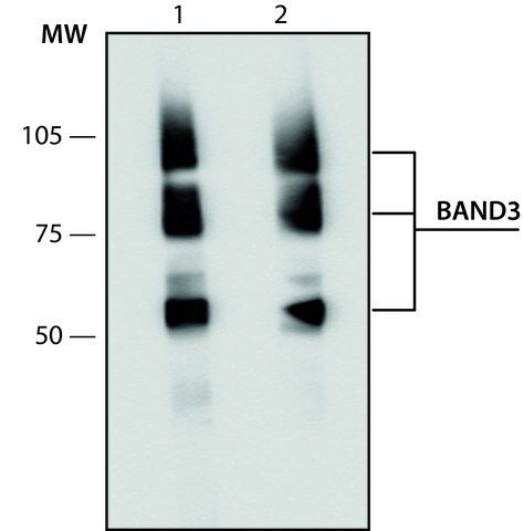 Anti-Band 3 antibody, Mouse monoclonal