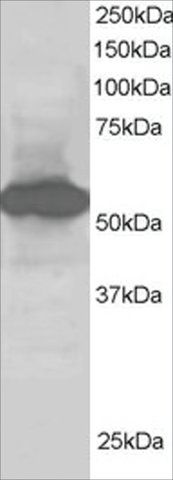 Anti-BAP/SIL1 antibody produced in goat