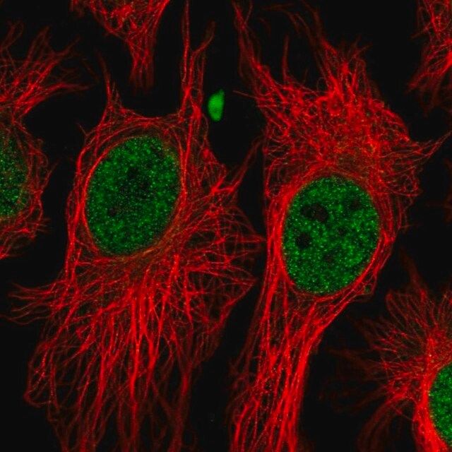 Anti-BAP1 antibody produced in rabbit