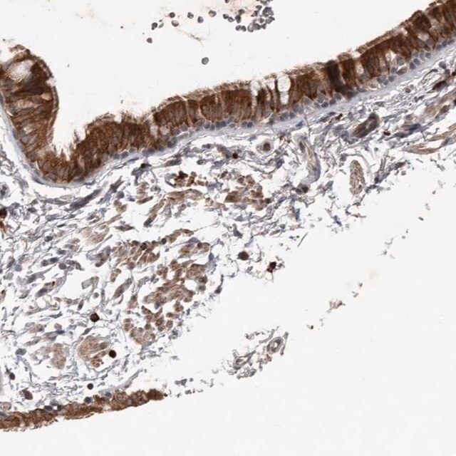 Anti-BAMBI antibody produced in rabbit