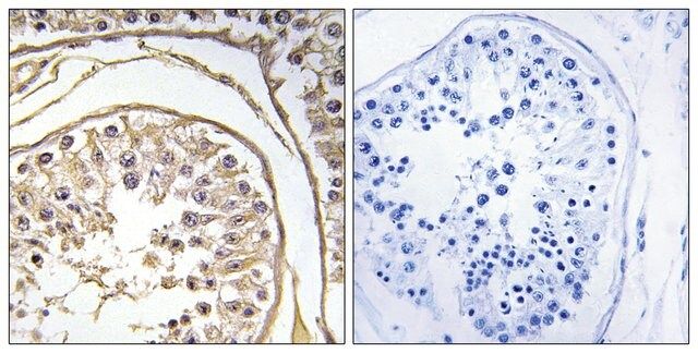 Anti-BAGE2 antibody produced in rabbit