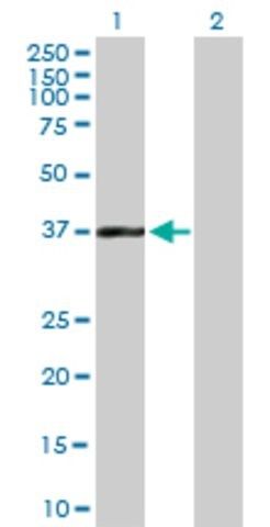 Anti-BAT4 antibody produced in mouse