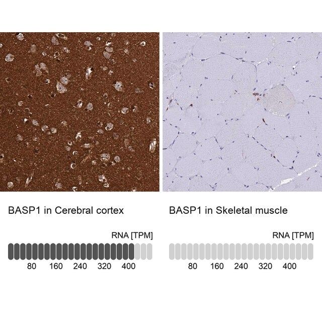 Anti-BASP1 antibody produced in rabbit